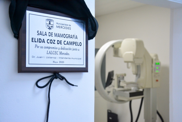 Mercedes cuenta con un nuevo mamógrafo