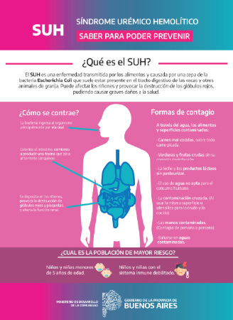 Posters difusión - SUH